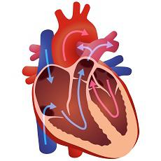 Mitral Valve Prolapse