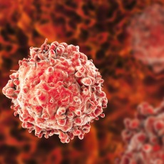 Chronic Lymphocytic Leukemia
