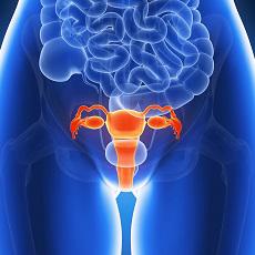 Ovarian Cysts