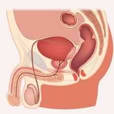 Testicular Disorders