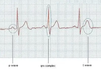 localStorage tested on Chrome 113.0.5672.63