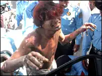 Failed attempt of immolation.