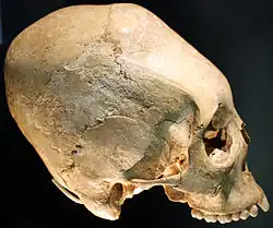 Landesmuseum Württemberg elongated skull, early 6th-century Alemannic culture