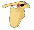 Classification type 2