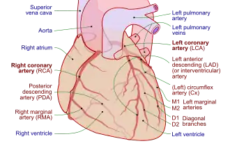 Coronary arteries (labeled in red text) and other major landmarks (in blue text). Left circumflex artery is labeled at right.