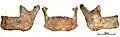 Burial 17 - The mandiblewas within the skullcap. Teeth were intentionally removed and burnt marks are limited to the alveolar margin.