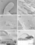 SEM of mature specimens of Echinorhynchus baeri