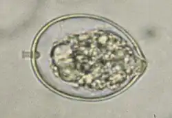 Microscopic view of sporangium of Phytophthora cactorum