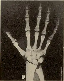 Hand