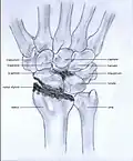 Stage IV