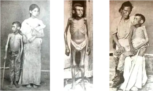 Image 12Cuban victims of Spanish reconcentration policies (from History of Cuba)