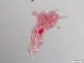 Amoeba with ingested diatoms